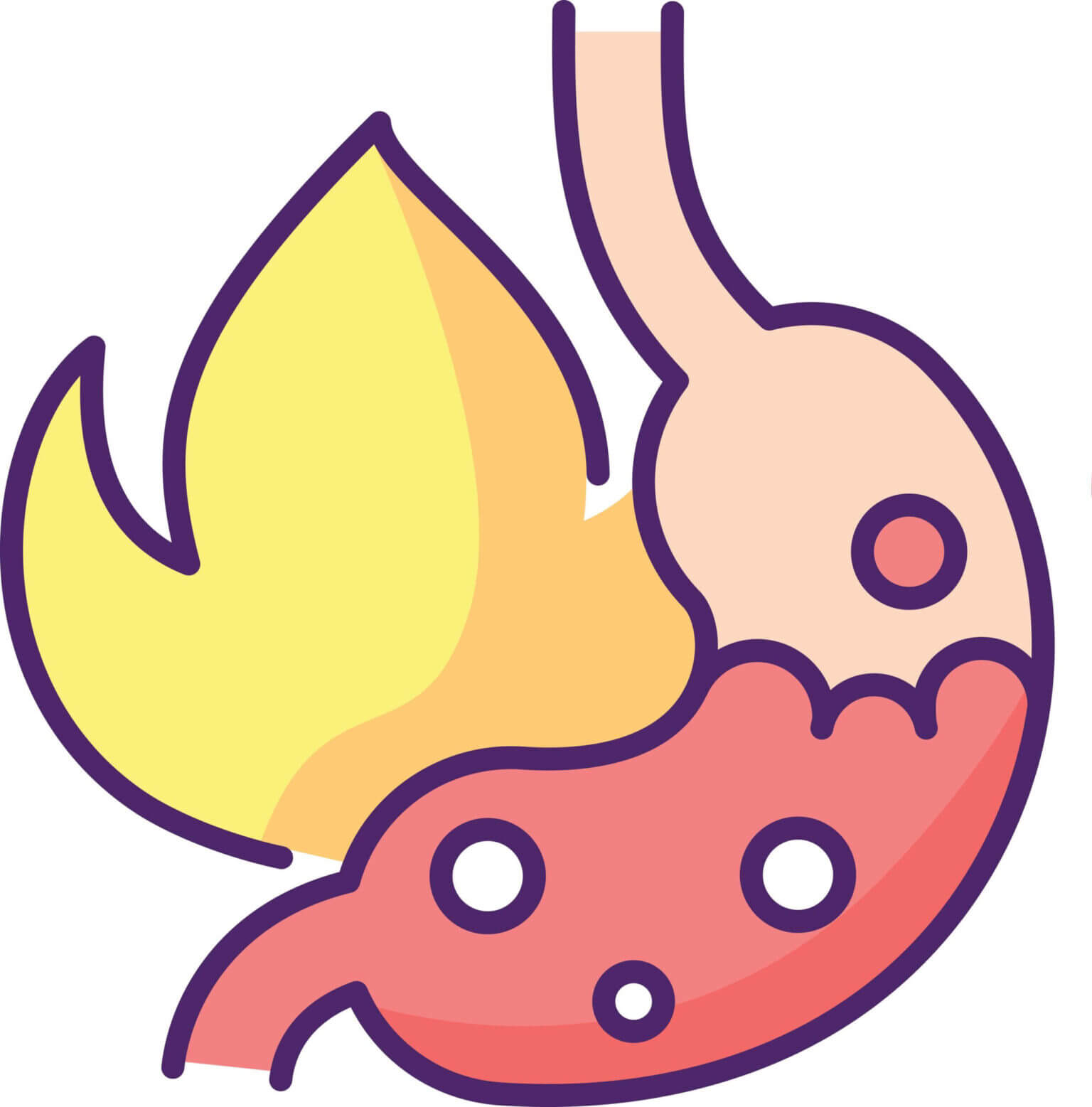 heartburn illustration